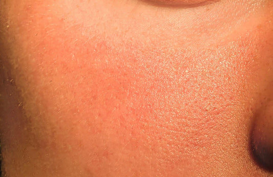 From Clogged to Clear: The Moroccan Ritual for Refined Pores