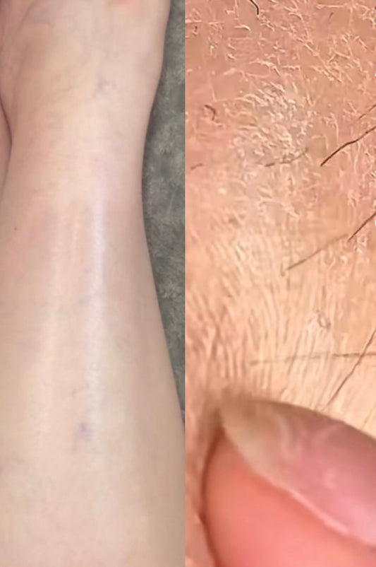 From Flaky to Flawless: Repairing Your Skin Barrier Naturally